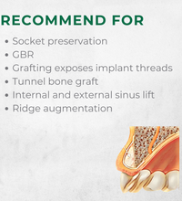 Vitality™ 1.0 CC Mineralized 70/30 Cortical Cancellous Mix 500- 1000 Micron Allograft Bone