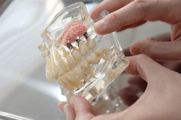Cancellous vs Cortical Bone Graft: Benefits of Mixing for Superior Bone Regeneration
