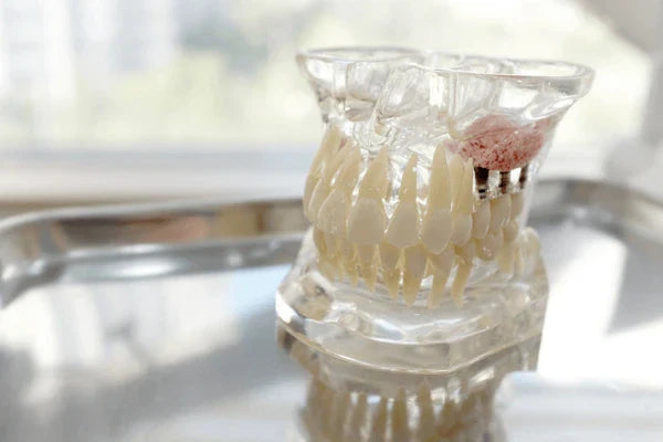 Bone Graft Materials in Oral Surgery and Implant Dentistry