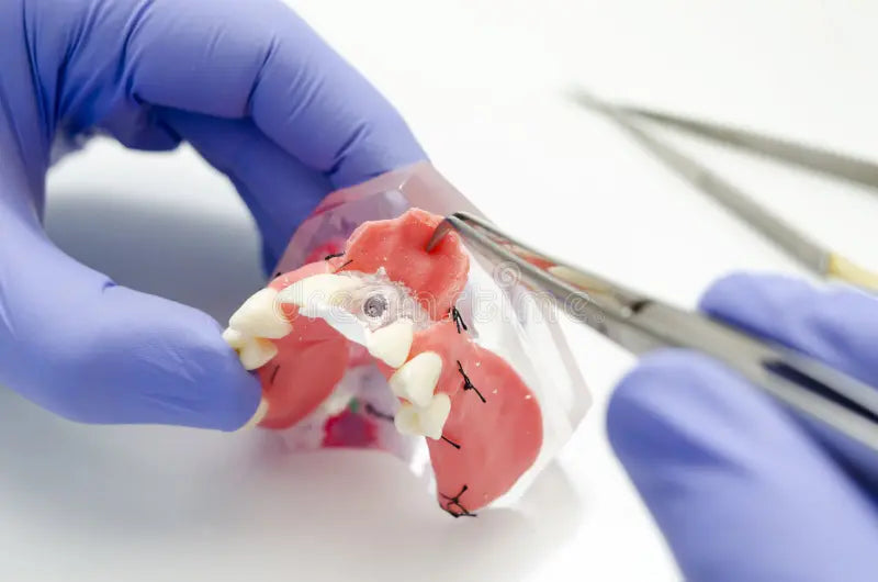 Chromic Gut Suture Q&A: Uses, Features, and Healing Timeline