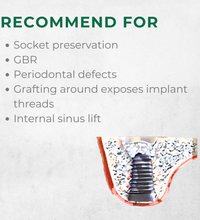 Vitality™ 0.5 CC Mineralized 70/30 Cortical Cancellous Mix 500- 1000 Micron Allograft Bone