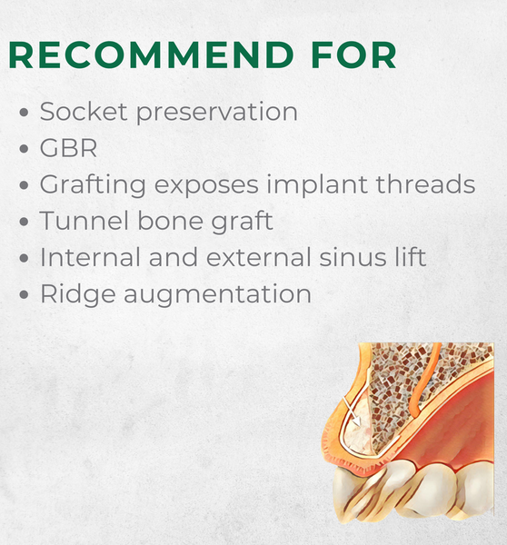 Vitality™ 1.0 CC Mineralized 70/30 Cortical/Cancellous Allograft Blend