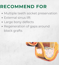 Vitality™ 2.0 CC Mineralized 70/30 Cortical Cancellous Mix 500- 1000 Micron Allograft Bone