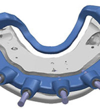 Ridge Reduction/ Contouring Bur (5 Per Pack)-Vitality™